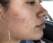 Liltriste Bbytriste Hot photos Tristeluna Tristebby XXX